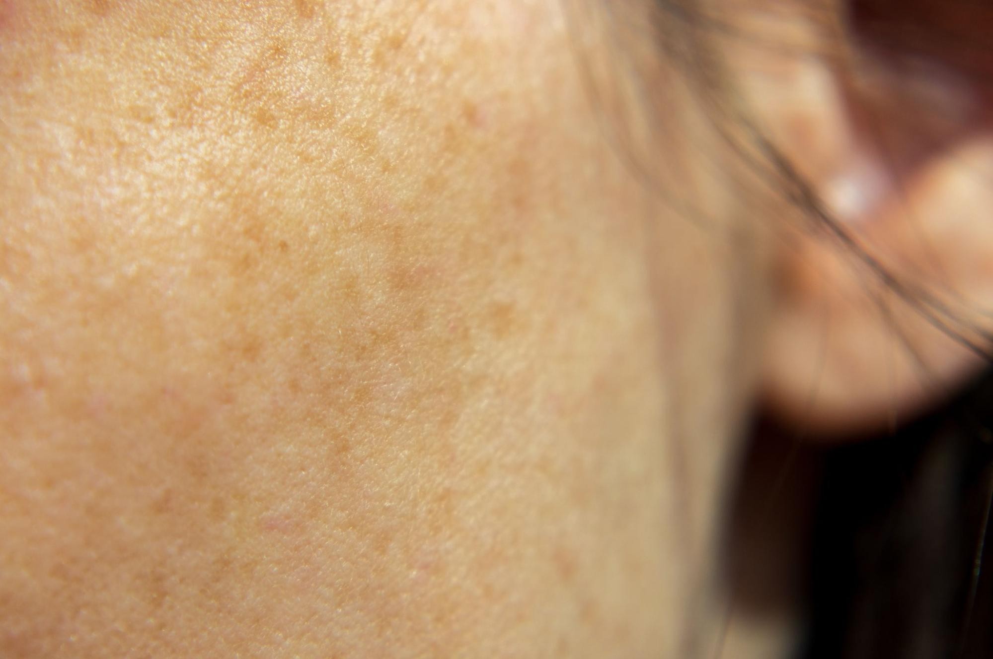 おすすめ治療やセルフケア方法も解説