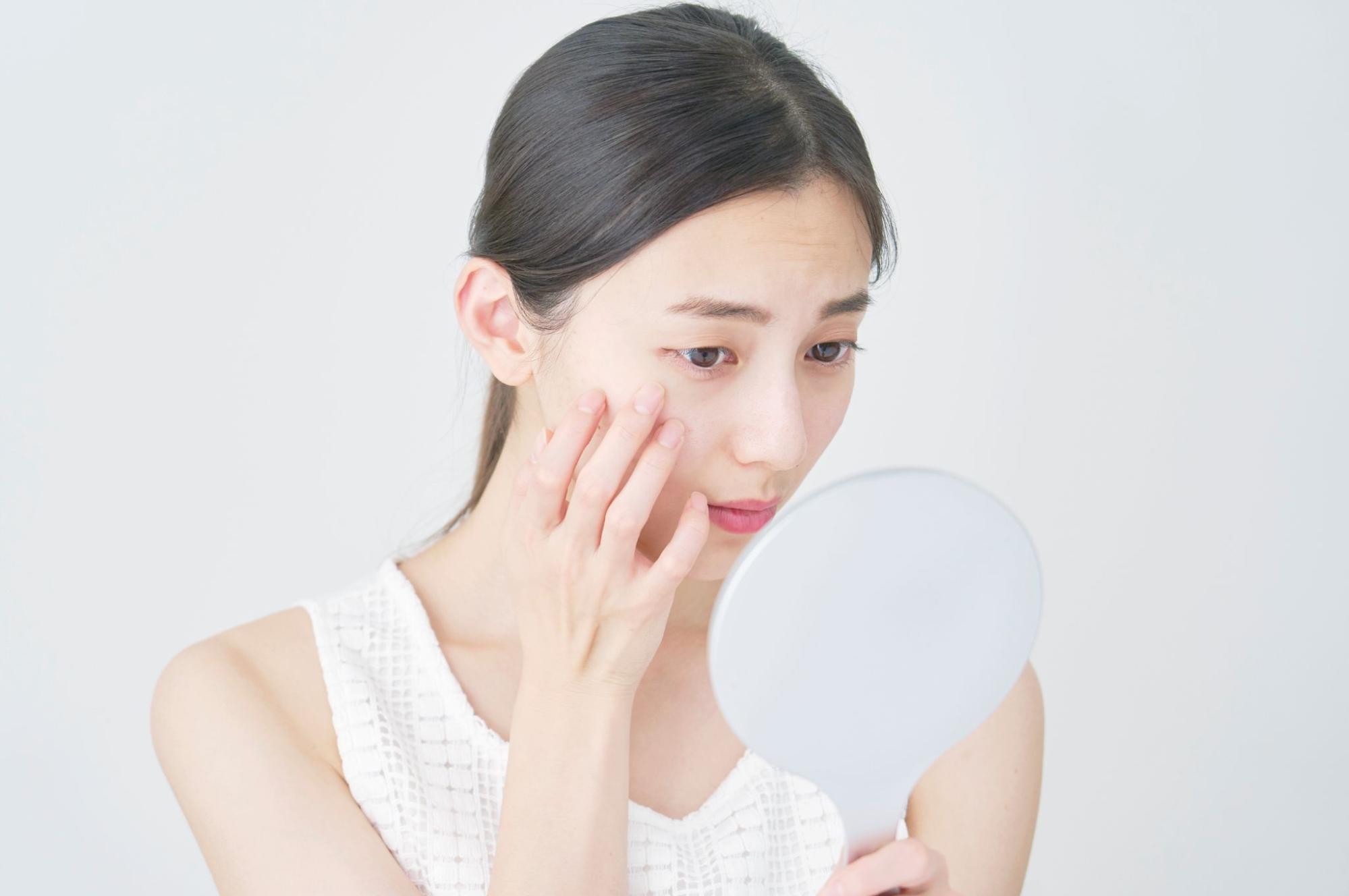 シミ取りレーザーとは？